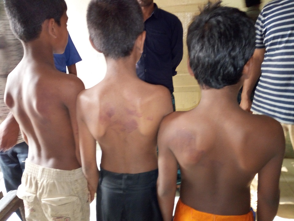 অংক না পারায় ৩ শিক্ষার্থীকে মেরে আহত