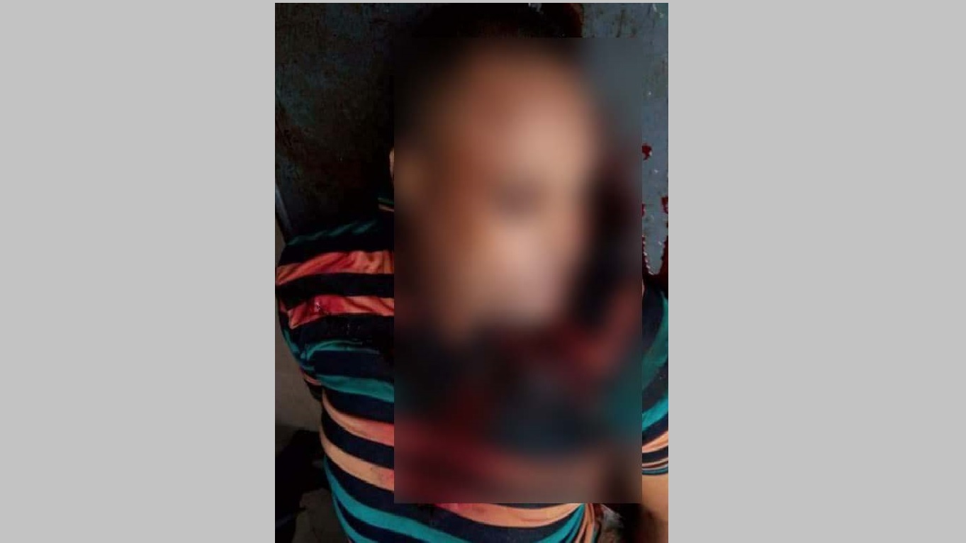 শ্যামনগরে ‘বন্দুকযুদ্ধে’ বাইক চোর চক্রের হোতা নিহত