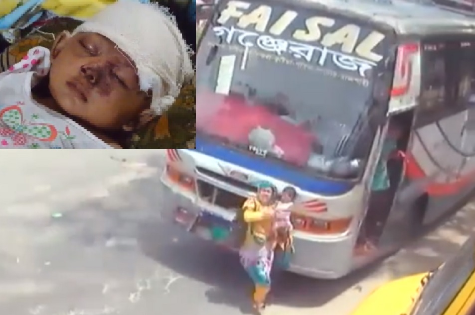 বাসের ধাক্কায় আহত শিশু আকিফা ঢাকা মেডিকেলে