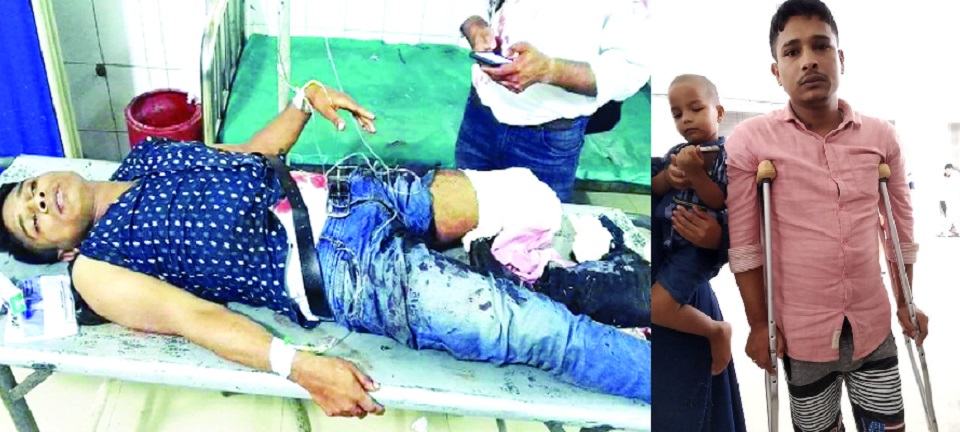 পা হারানো প্রাইভেটকার চালককে ৫০ লক্ষ টাকা ক্ষতিপূরণ দেয়ার নির্দেশ