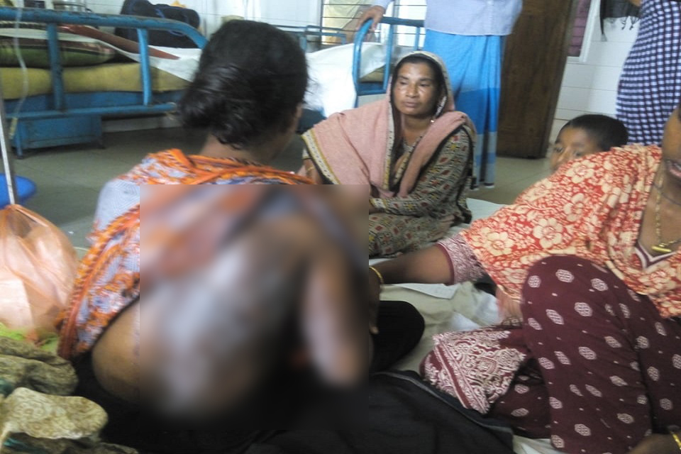 স্বামীর ঢেলে দেয়া গরম পানিতে ঝলসে গেল অন্তঃসত্ত্বা স্ত্রীর শরীর