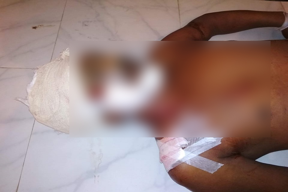 রাজবাড়ীতে ট্রাক চাপায় প্রতিবন্ধী রিক্সা চালক নিহত: হেলপারসহ ট্রাক আটক