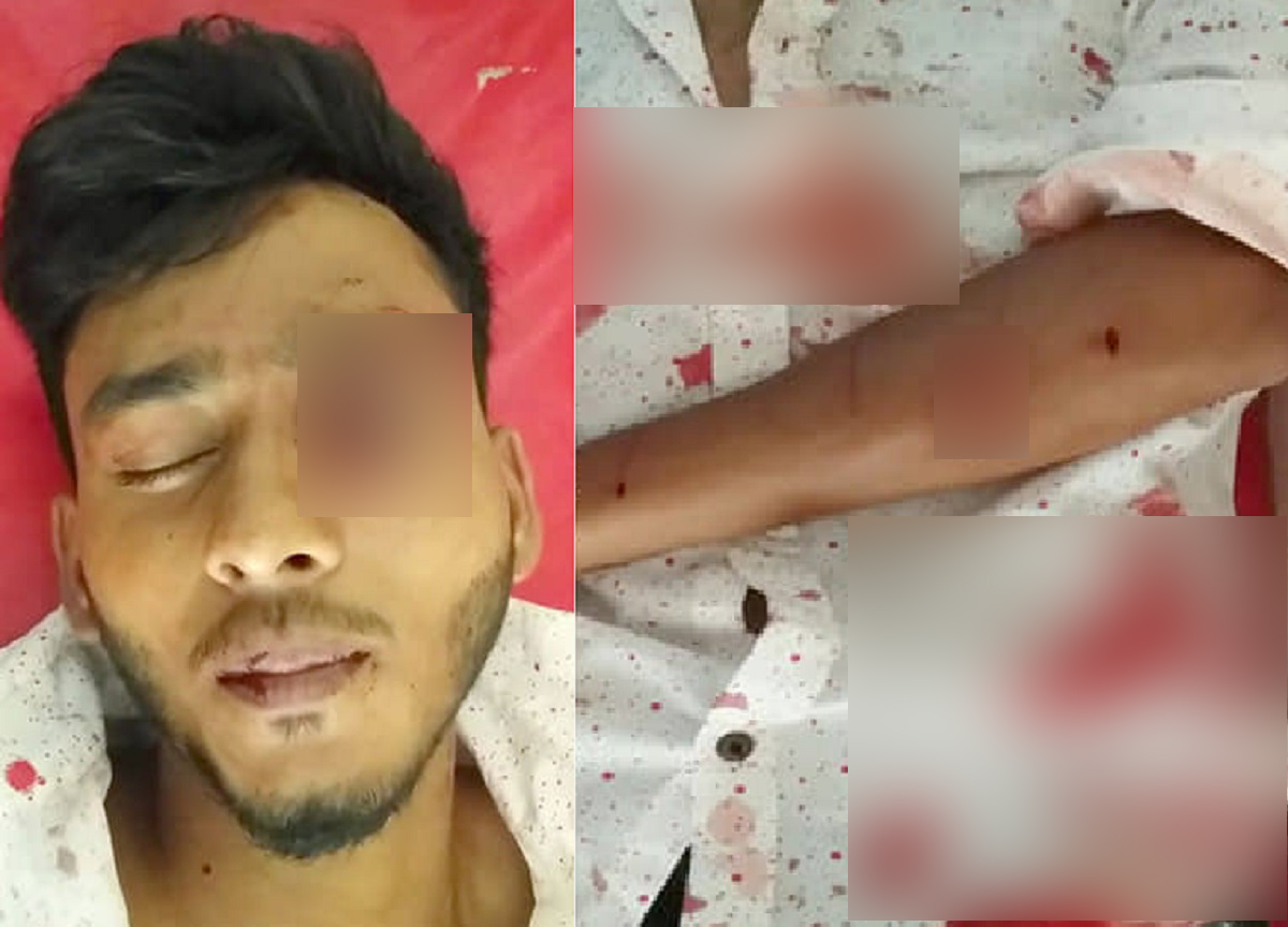 এবার ‘বন্ড স্টাইলে’ কলেজছাত্রকে কুপিয়ে জখম