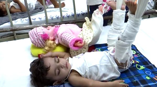 পুতুল ইঞ্জেকশন নিচ্ছে দেখে কান্না থামাল শিশুর, অস্ত্রোপচারে সক্ষম হলেন ডাক্তাররা