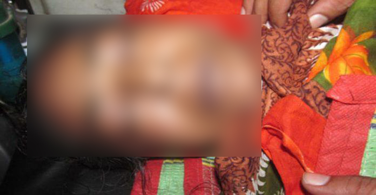 যশোরে ডেঙ্গুতে আক্রান্ত নারীর মৃত্যু