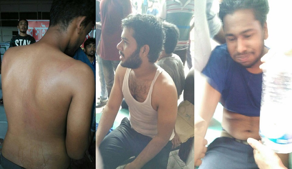 বশেমুরবিপ্রবি’র শিক্ষার্থীদের উপর বহিরাগতদের হামলা, আহত অন্তত ২০