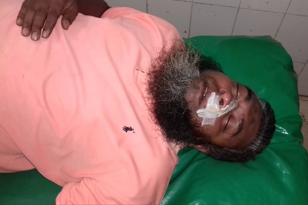 বাউফলে দুই সাংবাদিকের উপর যুবলীগ কর্মীর হামলা