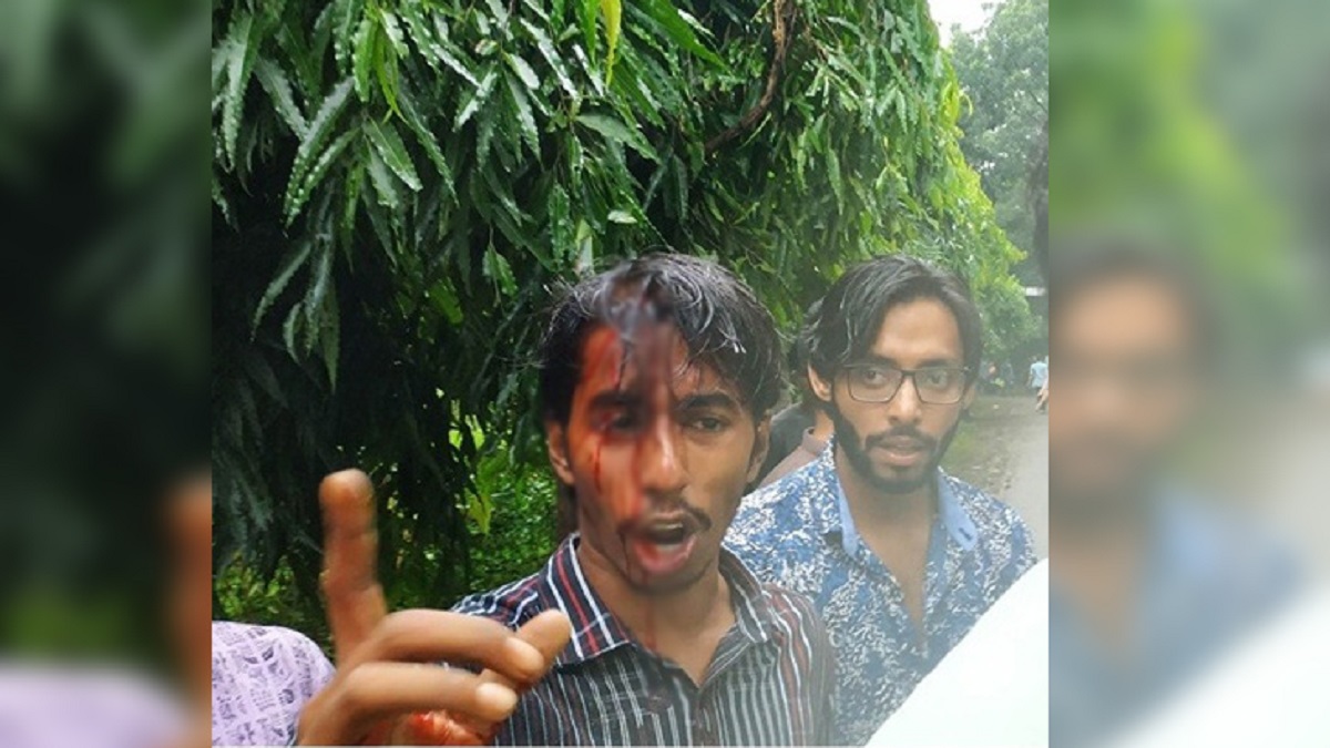 মদের বোতল দিয়ে জাবি ছাত্রলীগ কর্মীর মাথা ফাটাল আরেক কর্মী