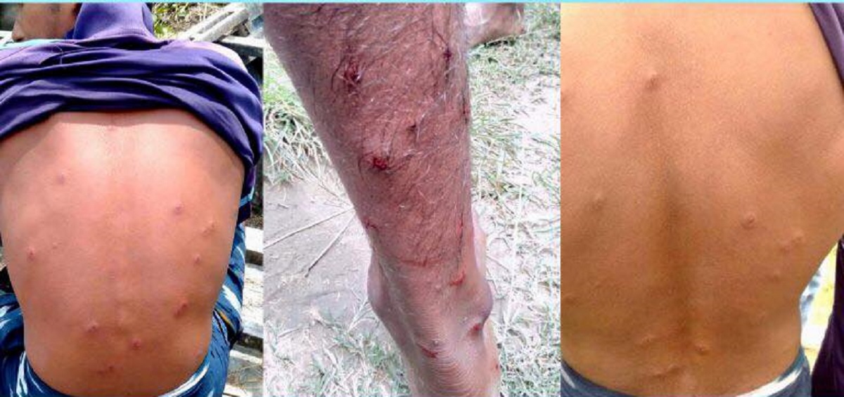 রাজশাহী সীমান্তে বিএসএফের গুলিতে ৫ বাংলাদেশি আহত