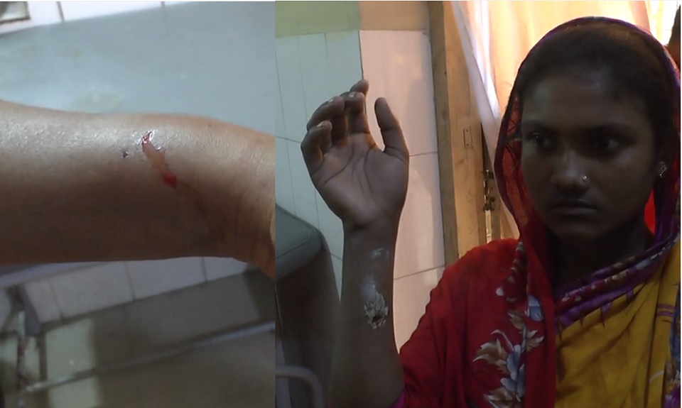 পাগলা কুকুরের আতঙ্ক দুই গ্রামে, কামড়িয়েছে ৩০ জনকে