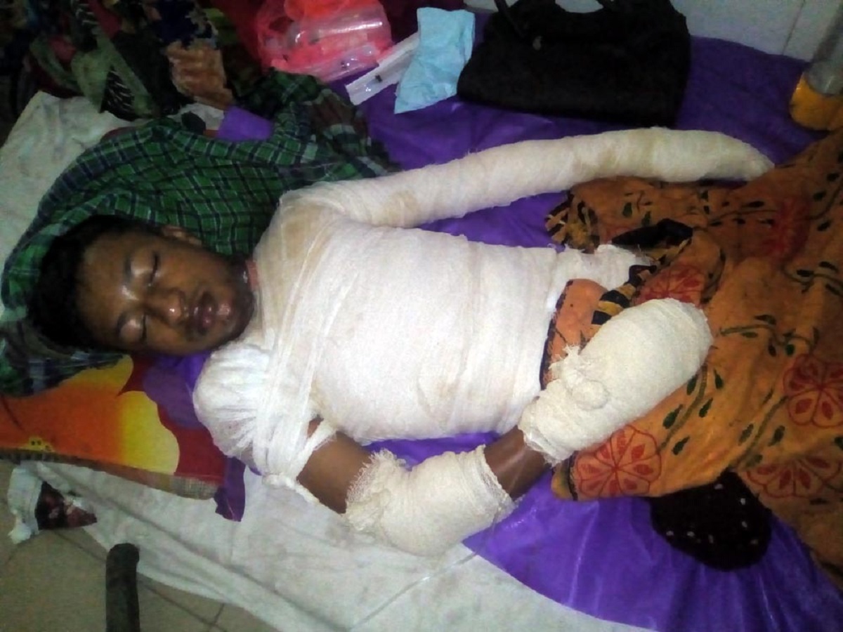 বরিশালে মাদ্রাসাছাত্র অগ্নিদগ্ধ