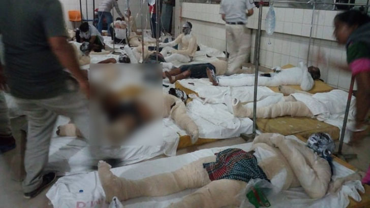 মোস্তাকিম-রাজ্জাকের পর মারা গেলেন দগ্ধ সাইদও