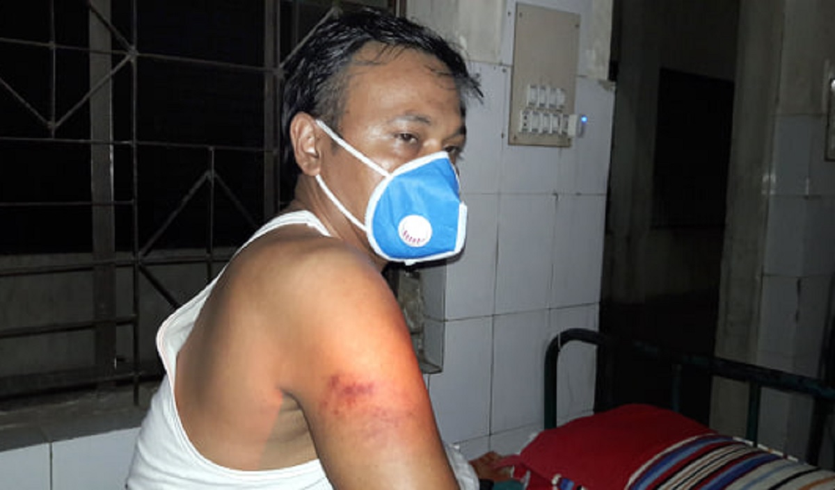 মাস্ক না পরায় চাকরিজীবীকে পুলিশের পেটানোর অভিযোগ, হাসপাতালে ভর্তি