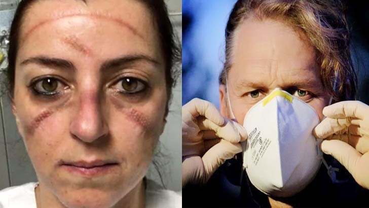 মাস্ক ব্যবহার: ত্বকের ক্ষতি রোধে বিশেষজ্ঞদের ৩ পরামর্শ