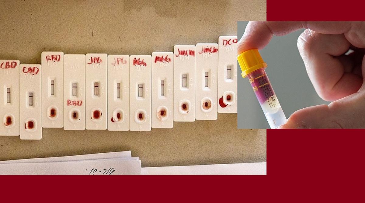 করোনাভাইরাস আক্রান্তদের মাত্র ১০ শতাংশের শরীরে অ্যান্টিবডি তৈরি হয়েছে! করোনাভাইরাস আক্রান্তদের মাত্র ১০ শতাংশের শরীরে অ্যান্টিবডি তৈরি হয়েছে!