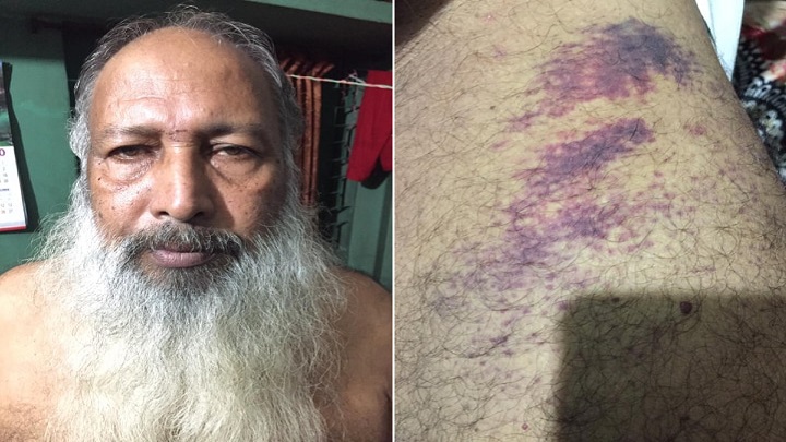 গাজীপুরে পাওনা টাকা চাওয়ায় সাবেক চেয়ারম্যানকে পিটিয়ে জখম