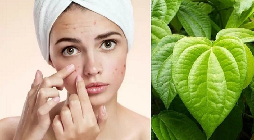 ব্রণ দূর করতে পান পাতা