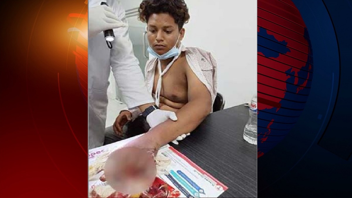 মাদকের বিরুদ্ধে প্রতিবাদ করায় স্কুলছাত্রের আঙ্গুল কেটে নিলো মাদক ব্যবসায়ীরা