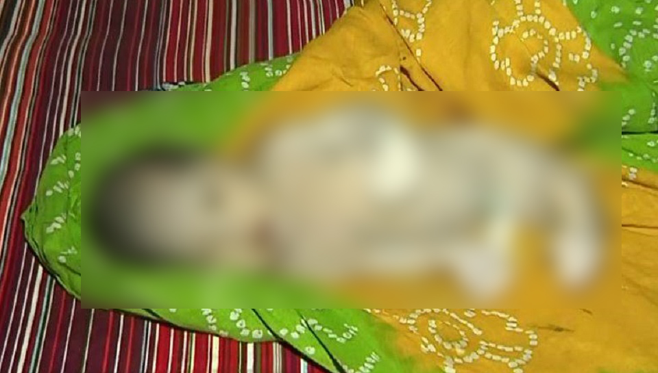 বগুড়ায় মৎসকন্যা আকৃতির শিশুর জন্ম