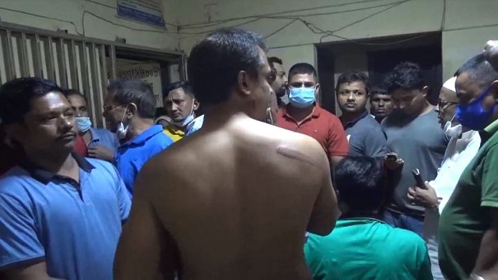 নবীনগরে যুবদলের সভায় পুলিশের লাঠিচার্জে আহত ২৫