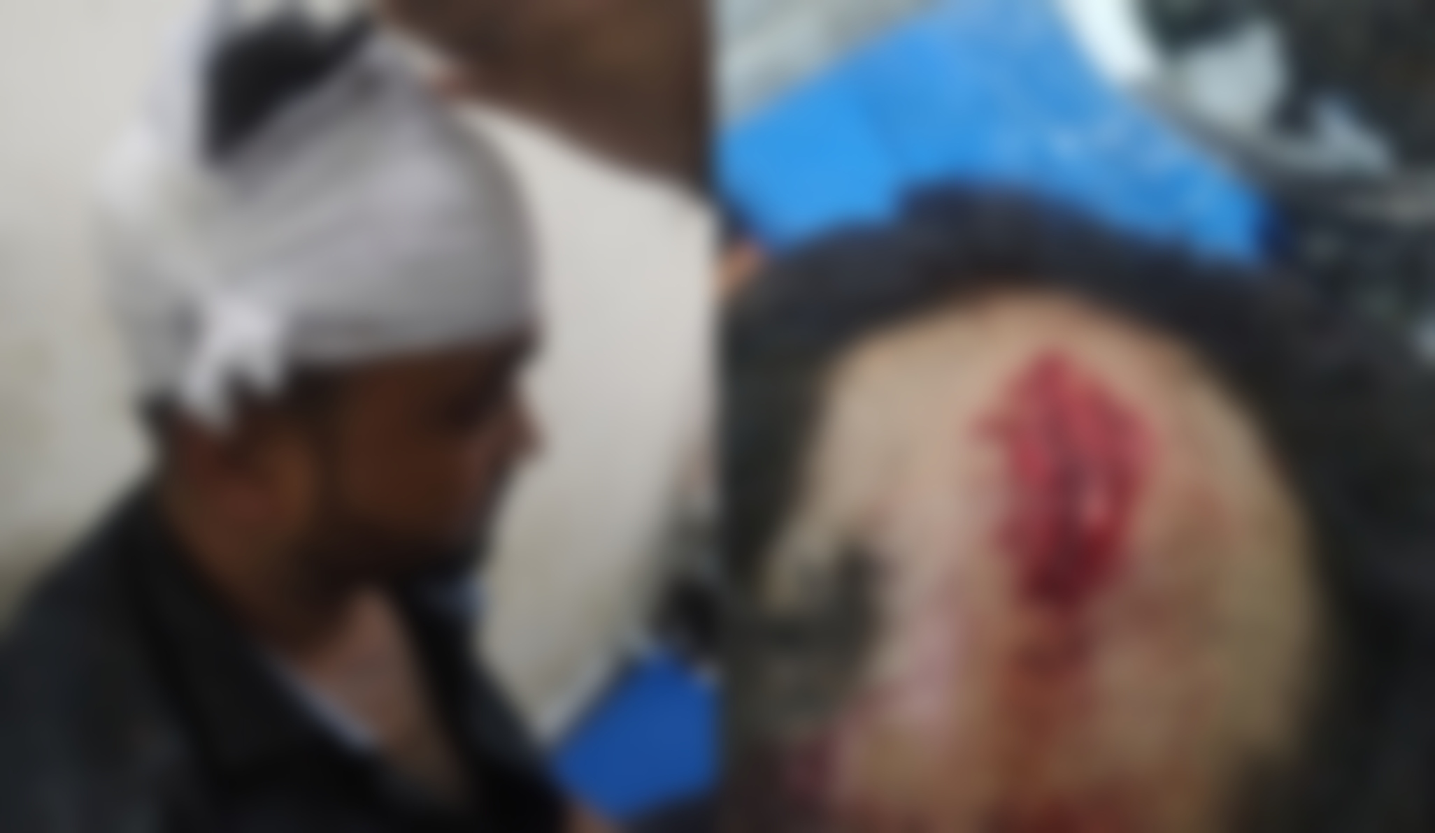 কলাপাড়ায় ছাত্রলীগের হামলায় বিএনপির উঠান বৈঠক পণ্ডের অভিযোগ; আহত ১০