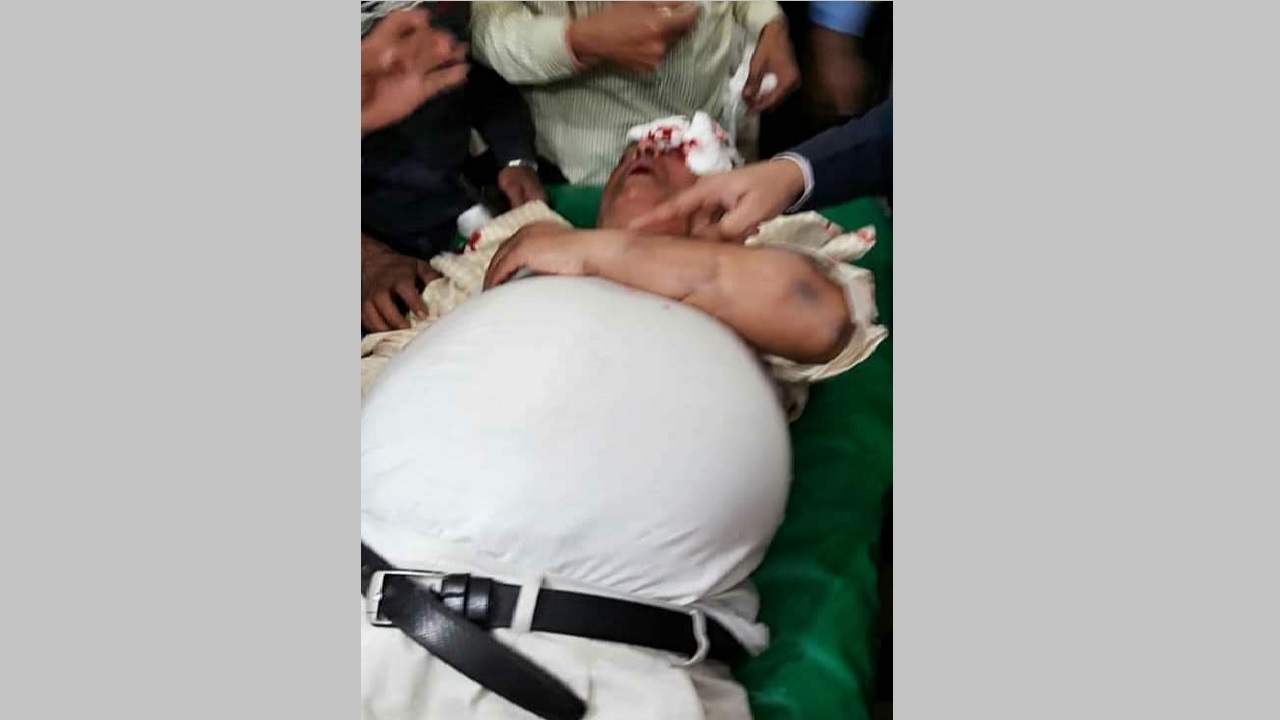 বাউফলে ফুলের তোড়া ভাঙা নিয়ে সংঘর্ষে ইউপি চেয়ারম্যানসহ আহত ১০