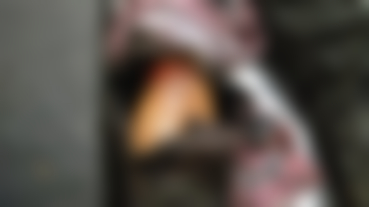 কুড়িগ্রামে সন্ত্রাসী হামলায় কলেজ শিক্ষকের হাত বিচ্ছিন্ন