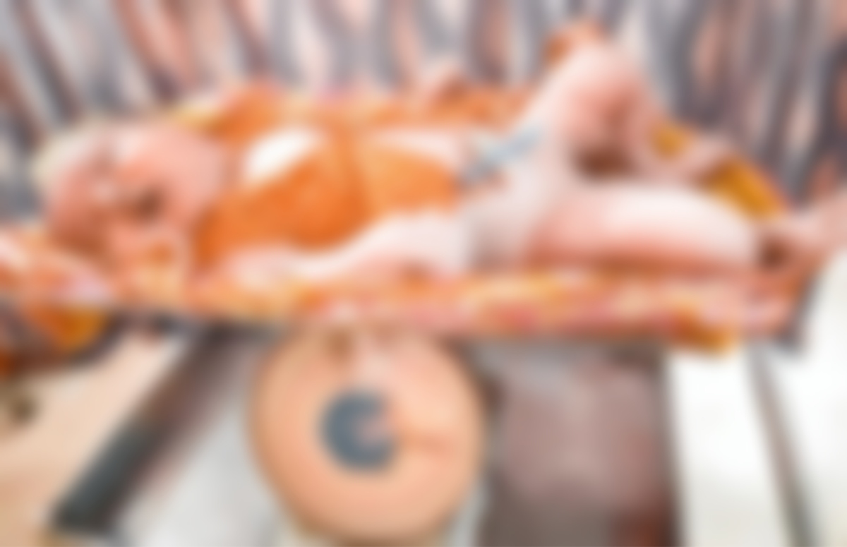 ব্রাহ্মণবাড়িয়ায় প্রায় ৬ কেজি ওজনের শিশুর জন্ম