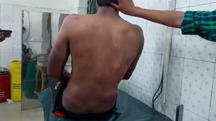 মুন্সিগঞ্জে কিশোর গ্যাংয়ের মারধরে যুবক গুরুতর আহত