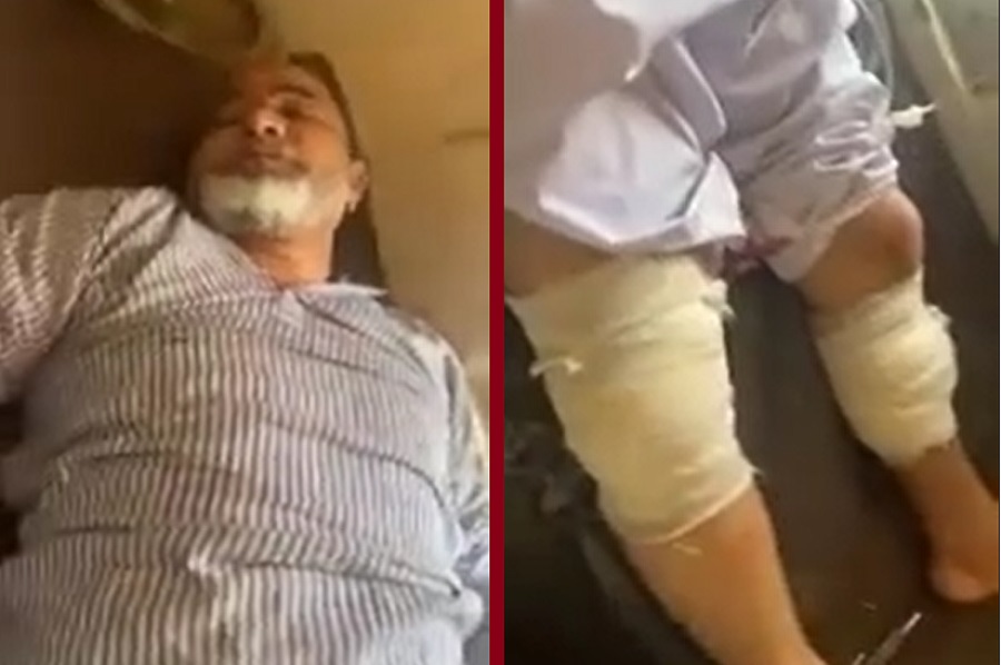 নোয়াখালীর কোম্পানীগঞ্জ উপজেলা আ.লীগের সাধারণ সম্পাদক গুলিবিদ্ধ