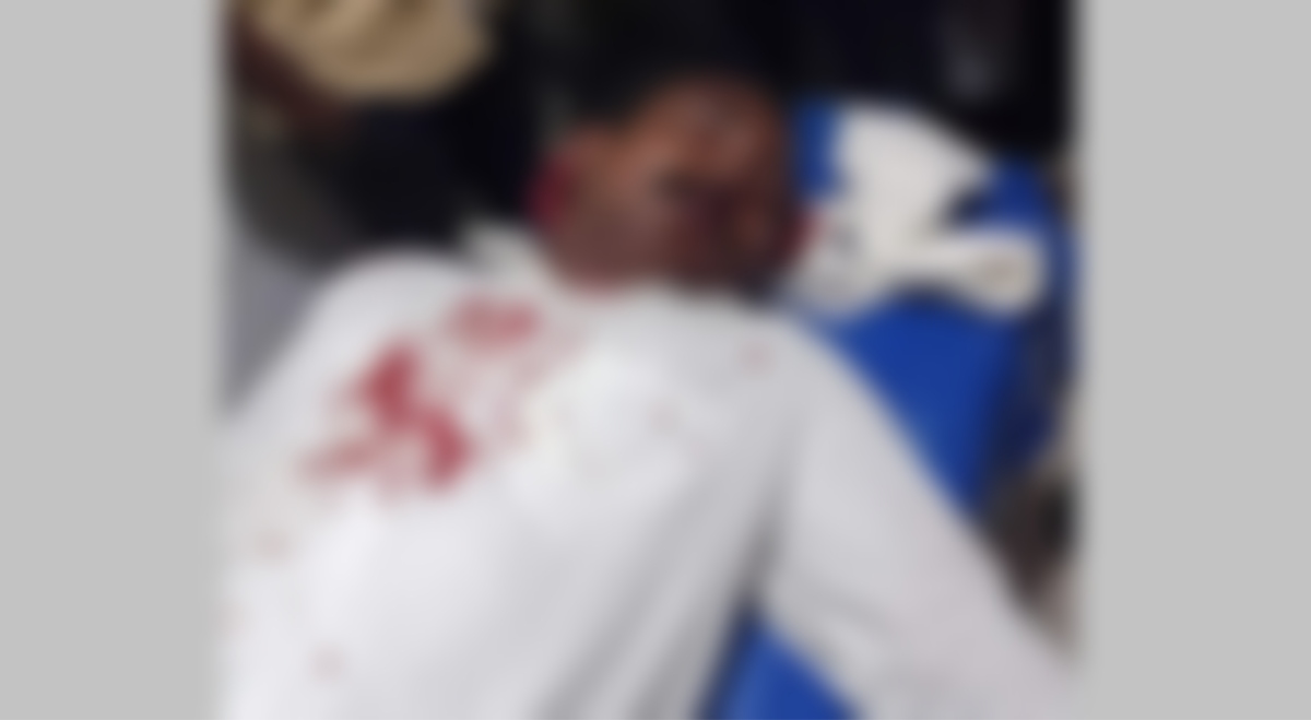 কুষ্টিয়া জেলা পরিষদের সদস্যকে কুপিয়ে জখম