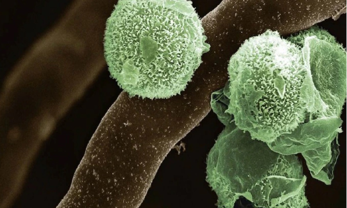 এবার ‘গ্রিন ফাঙ্গাস’ ধরা পড়ল ভারতে