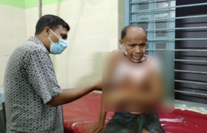 দাহ্য পদার্থ ঢেলে প্রতিবন্ধীর শরীরে আগুন