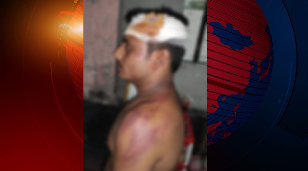 ভোট না দেয়ায় পুলিশের সামনেই নির্যাতন, গ্রাম ছাড়ার হুমকির অভিযোগ