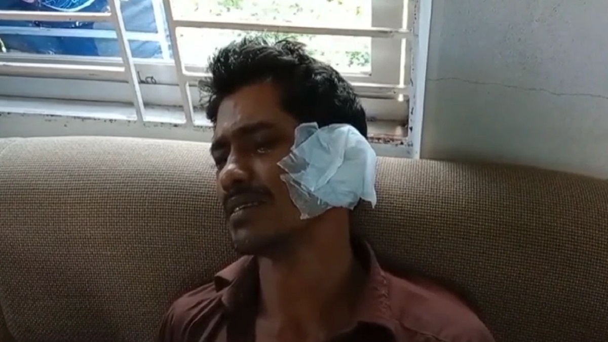 পাওনা টাকার জন্য কামড়ে কান ছিঁড়ে নেয়ার অভিযোগ