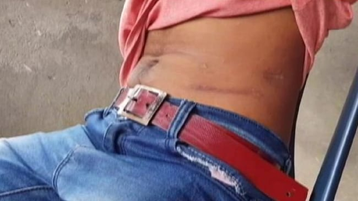 লকডাউনে আসামের দরিদ্ররা বাধ্য হচ্ছেন কিডনি বিক্রি করতে