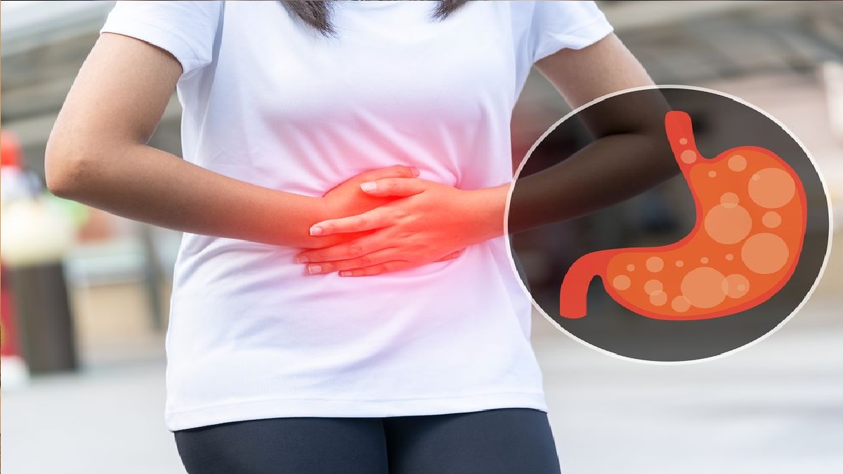 অ্যাসিডিটি থেকে মুক্তি পাওয়ার কিছু ঘরোয়া উপায়