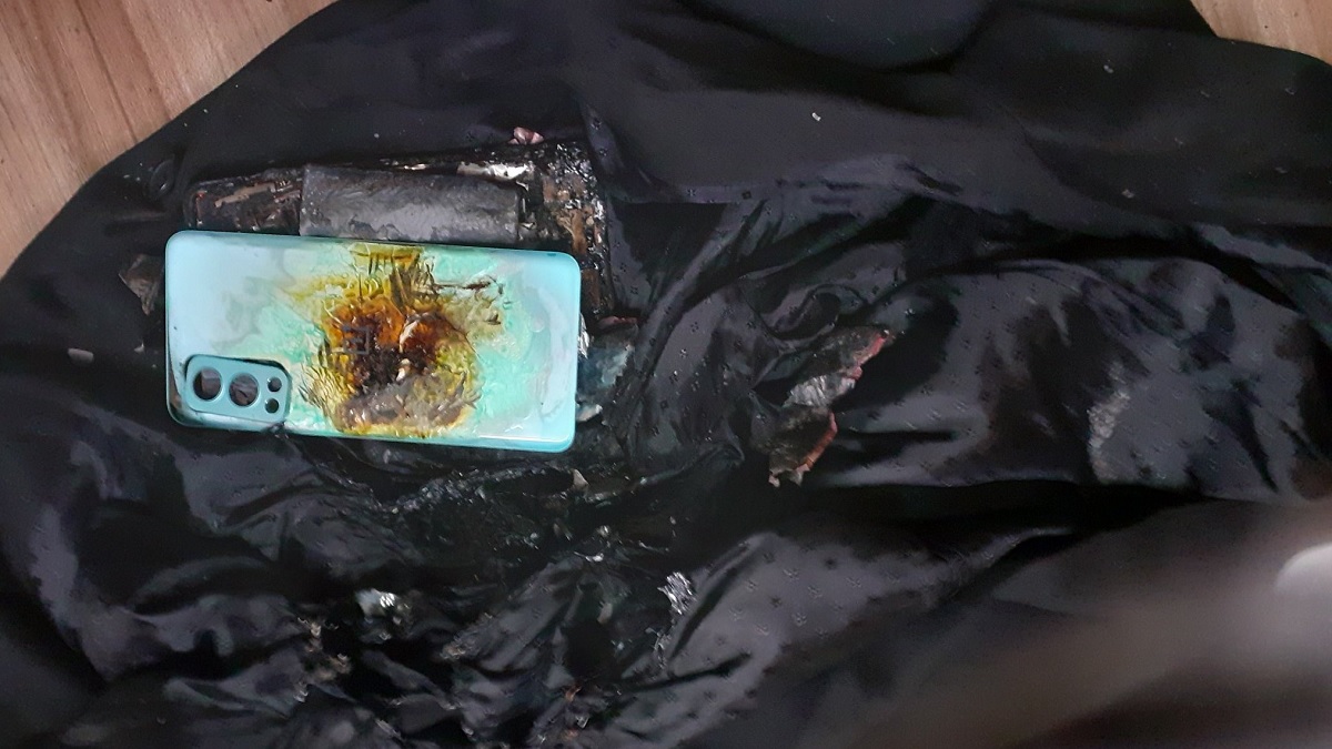 ওয়ানপ্লাসের ফোন বিস্ফোরিত হলো পকেটে