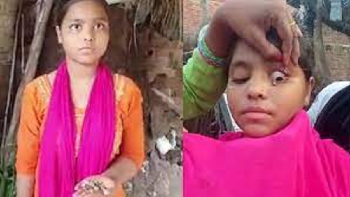 কাঁদলেই চোখ দিয়ে ঝরছে পাথর, ভারতে দানা বেধেছে কুসংস্কারও