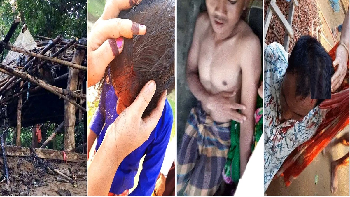 টেকনাফে চাকমা পল্লীতে দুই পক্ষের সংঘর্ষ, আহত ৮