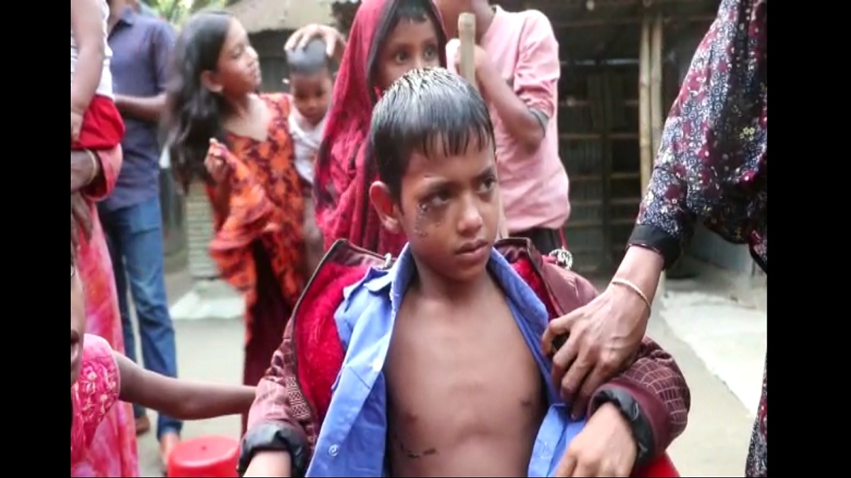 রহস্যময় এক প্রাণীর আক্রমণে গাইবান্ধার কয়েক গ্রামজুড়ে আতঙ্ক