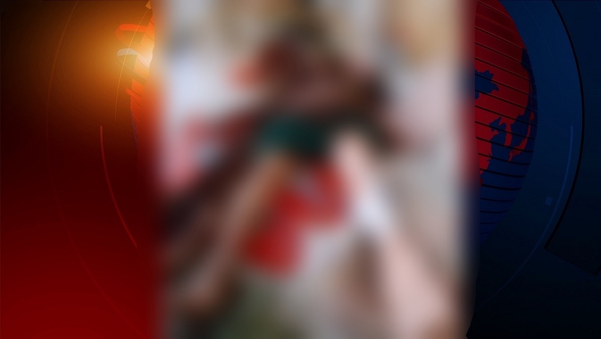 মামলা করায় পিটিয়ে শিক্ষিকার পা ভেঙে দিলো প্রভাবশালীরা