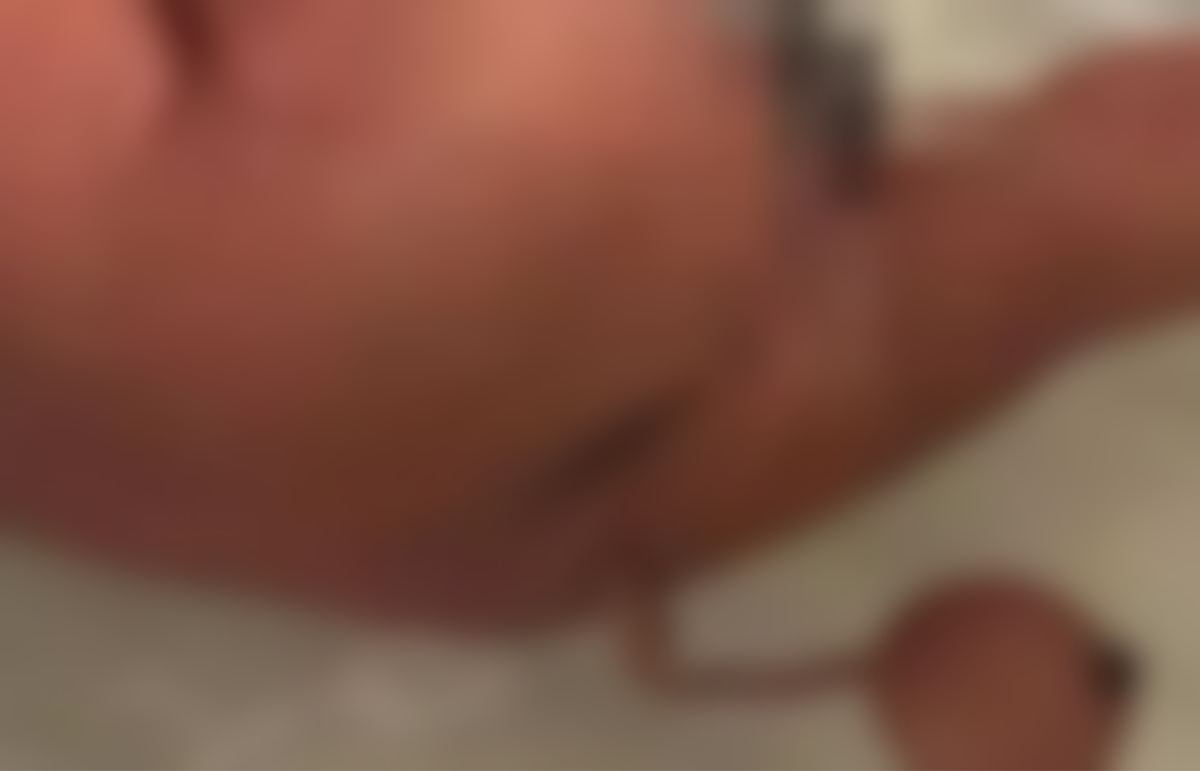 ১২ সেন্টিমিটার লেজসহ ভূমিষ্ঠ মানবশিশু!