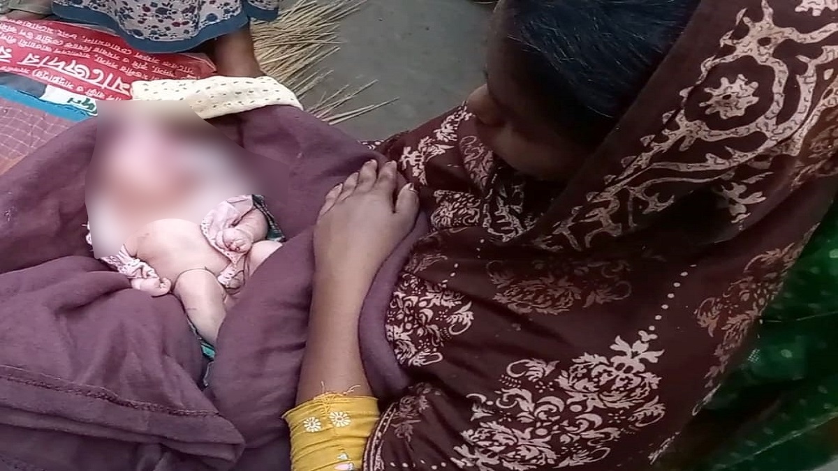 গাইবান্ধায় মাথার খুলিবিহীন এক শিশুর জন্ম