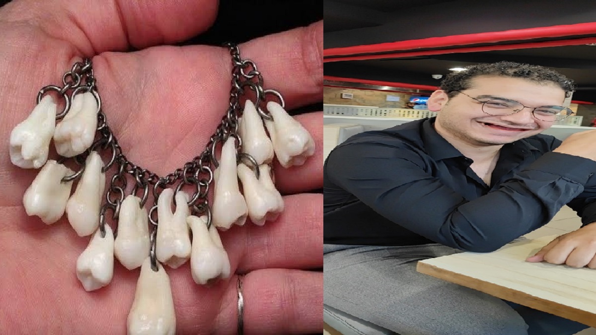 সব দাঁত তুলে নেকলেস বানিয়ে প্রেমিকাকে উপহার!