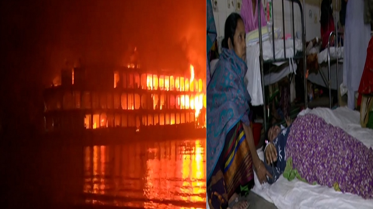 বরিশাল মেডিকেলে নেই বার্ন ইউনিট, ভোগান্তিতে দগ্ধরা