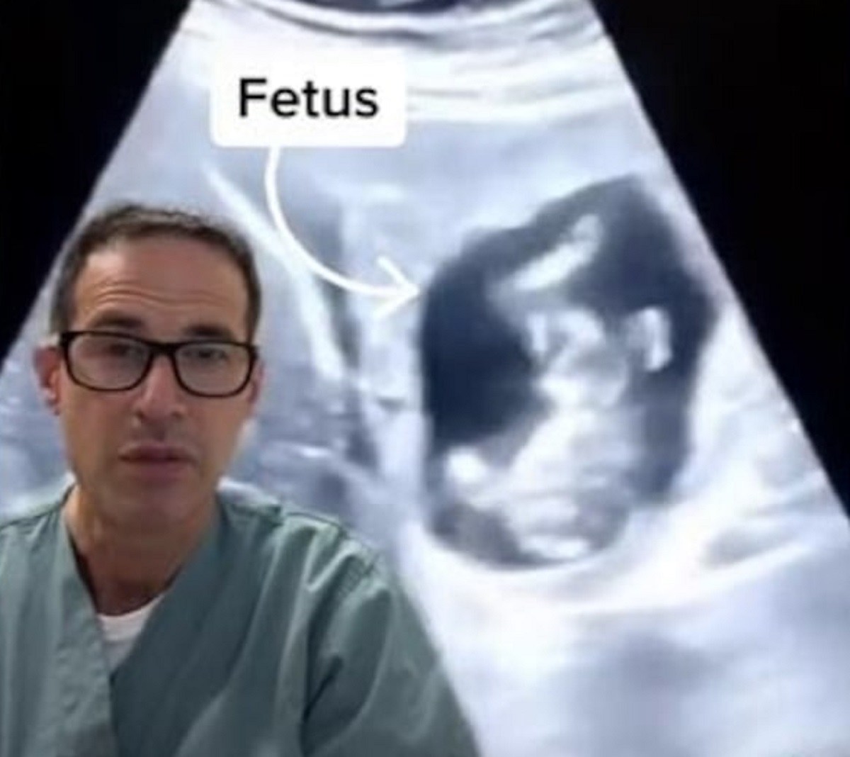 জরায়ুর বদলে লিভারে গর্ভধারণ করলেন নারী!