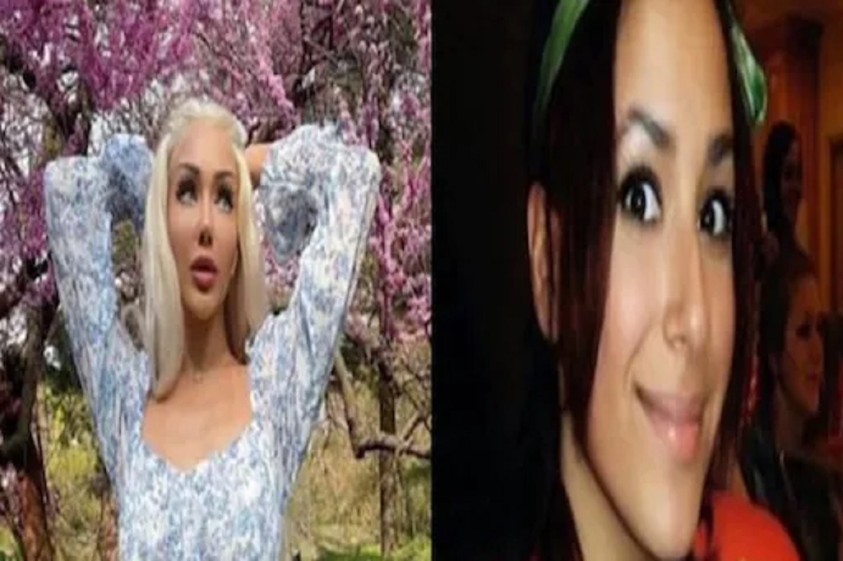 সাড়ে ১১ লাখ খরচ করে সৌন্দর্য বাড়িয়েও খুশি নন মডেল! ফিরে পেতে চান পুরনো মুখ