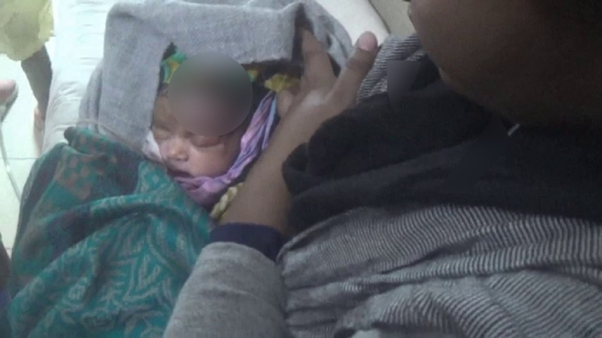 সিজার করলেন আয়া-নার্স, নবজাতকের কপালে ৯ সেলাই