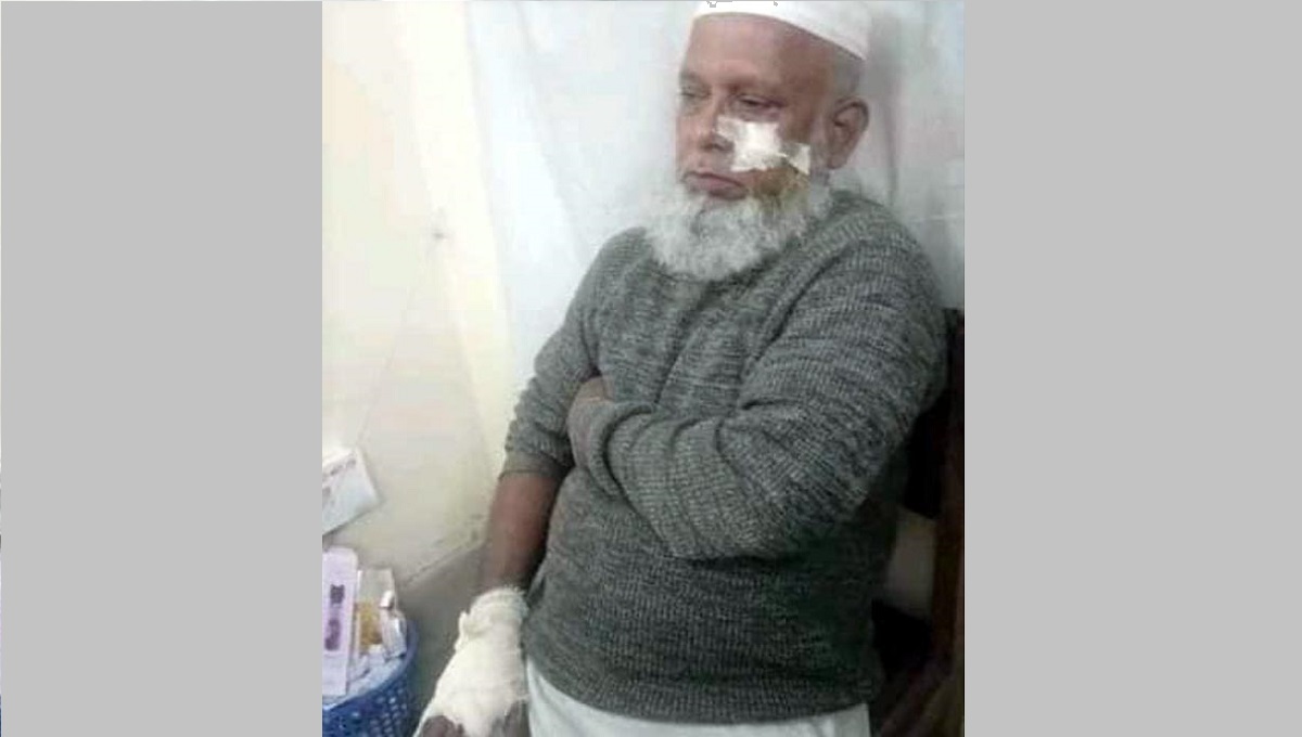 বরিশালে সাবেক ইউপি চেয়ারম্যানের হাত ভেঙে দেয়ার অভিযোগ আ. লীগ নেতার বিরুদ্ধে